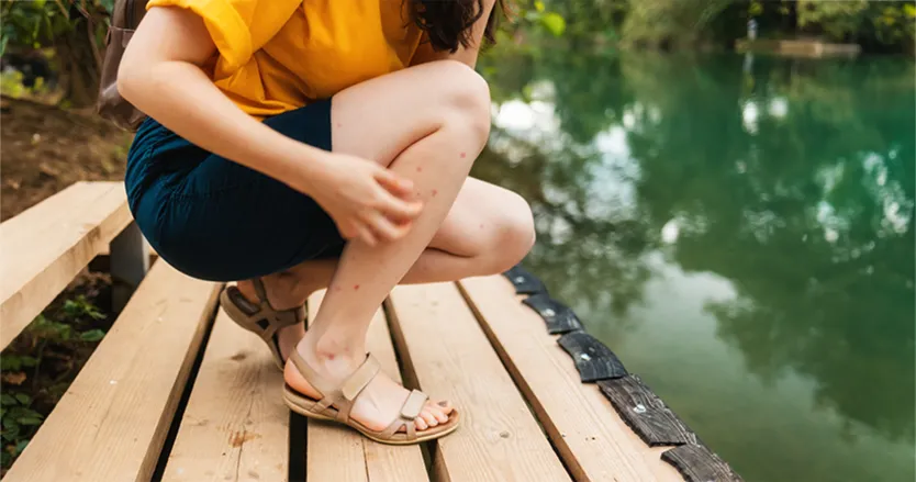 Woman kneeling on dock scratching mosquito bites on her legs
